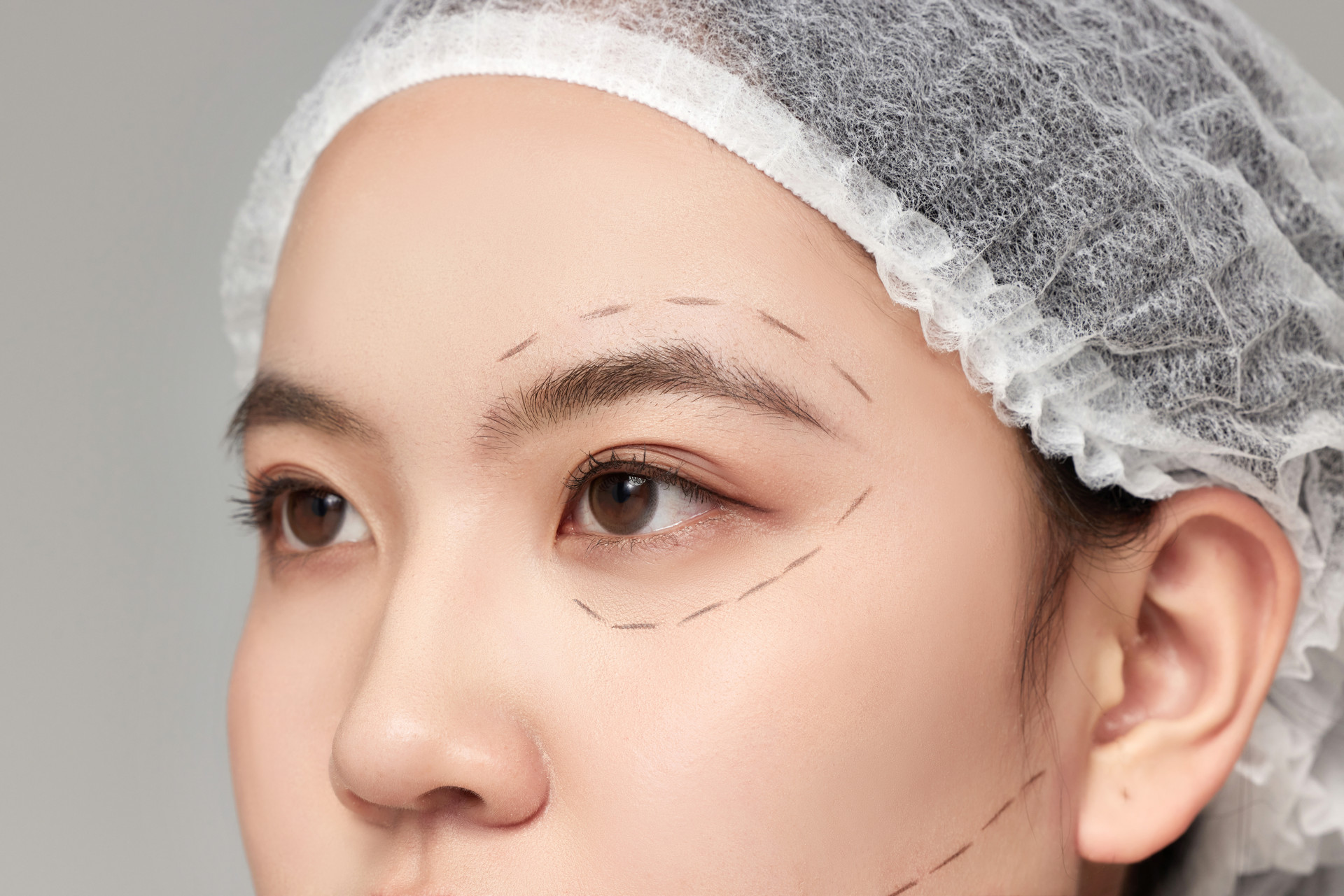 整形医生做好标记